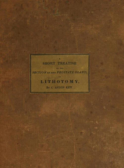 A Short Treatise on the Section of the Prostate Gland in Lithotomy With an Explanation of a Safe and Easy Method of Conducting the Operation on the Principles of Cheselden A Short Treatise on the Section of the Prostate Gland in Lithotomy With an Explanation of a Safe and Easy Method of Conducting the Operation on the Principles of Cheselden